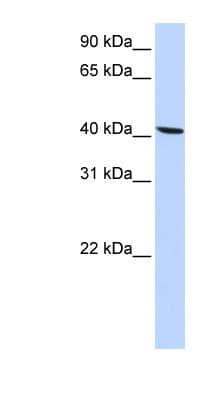 SLC22A18 Antibody (aa108-157)