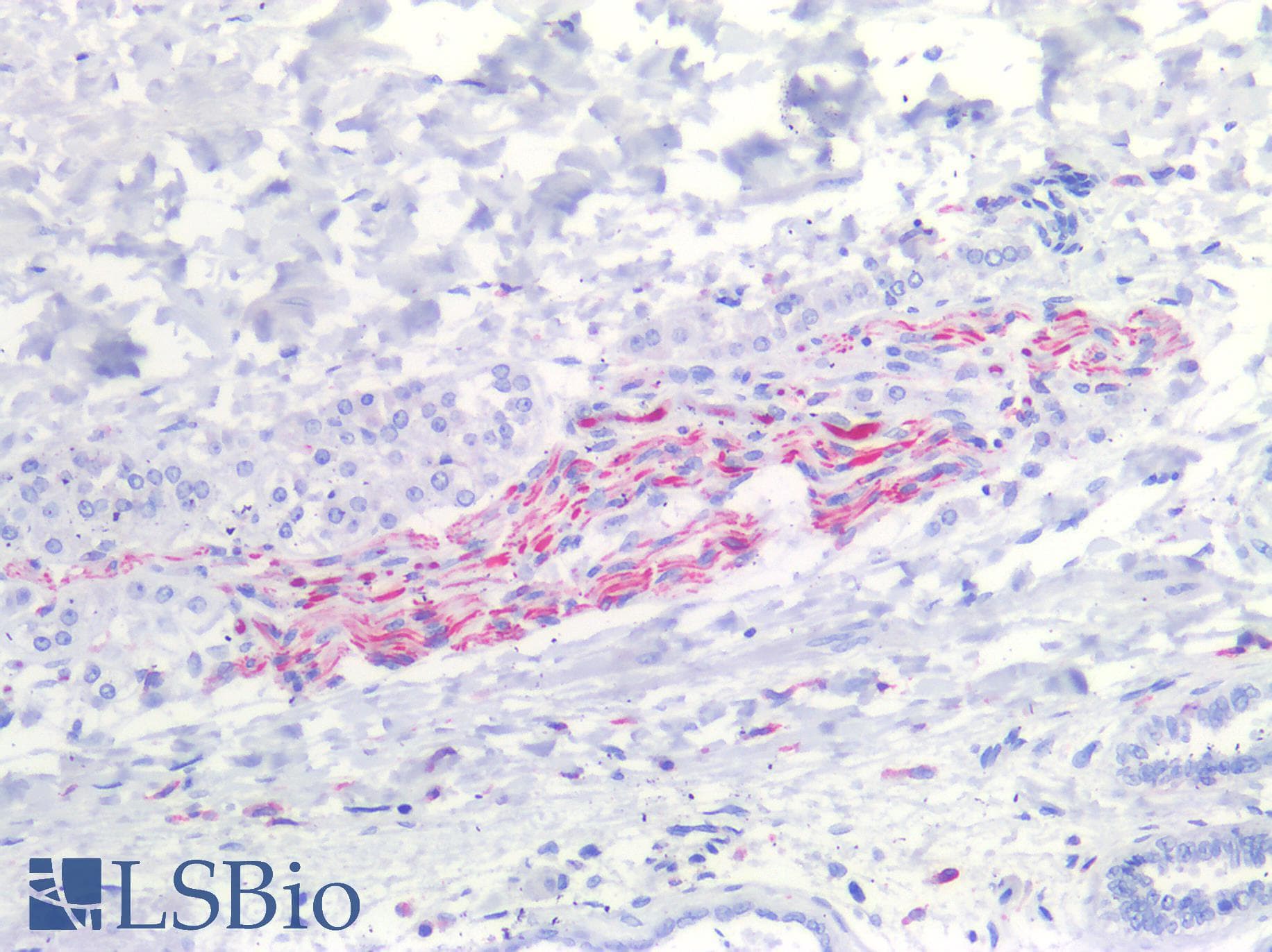 IHC-plus™ Polyclonal Rabbit anti-Human NEFH / NF-H Antibody (IHC)