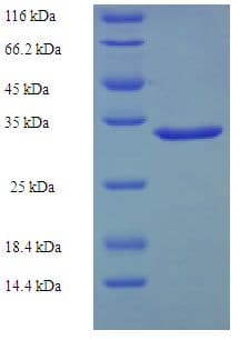 Human CR6 / GADD45G Protein (Recombinant His-SUMO)