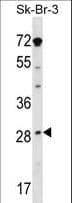 STAR Antibody (aa88-117)