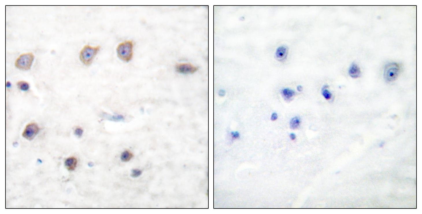 ADD1 / Adducin Alpha Antibody (phospho-Ser726)