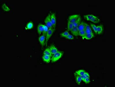 GRIA3 / GLUR3 Antibody (aa151-250)