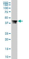 IHC-plus™ RPL4 / Ribosomal Protein L4 Antibody (clone 4A3)