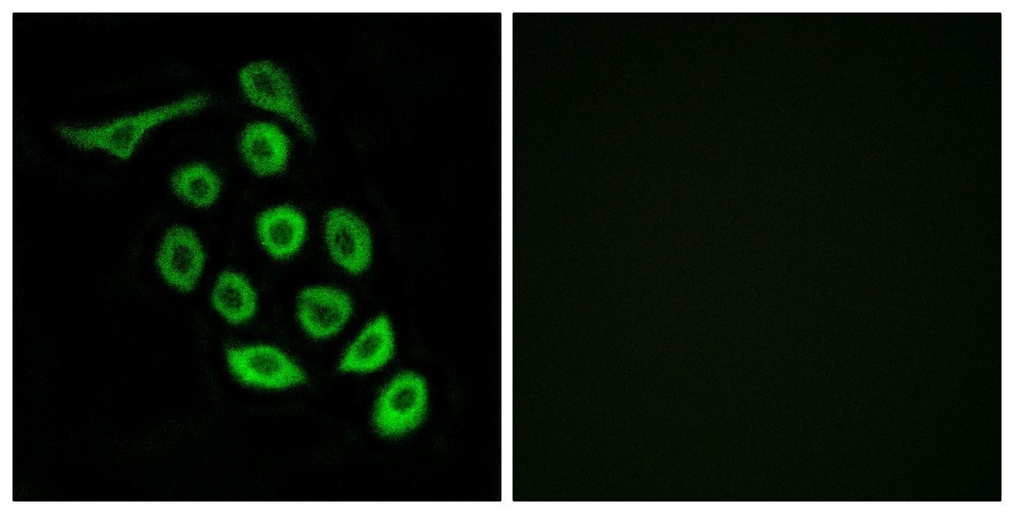 Polyclonal Rabbit anti-Human RPS12 / Ribosomal Protein S12 Antibody (IF, WB)