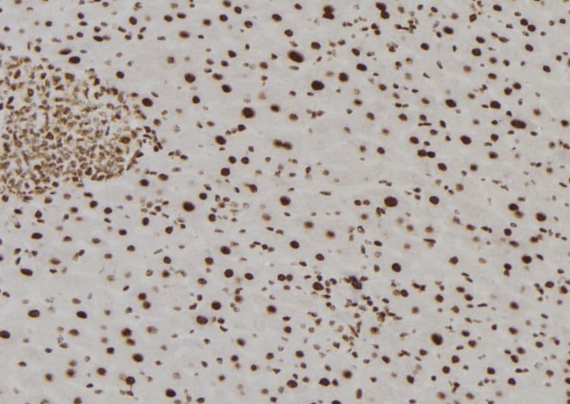 Polyclonal Rabbit anti-Human TMX2 / TXNDC14 Antibody (IHC, WB)