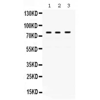 POLH / DNA Polymerase Eta Antibody (aa157-361)