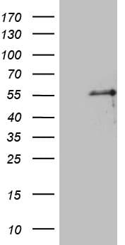 PTF1A Antibody (clone OTI1H6)