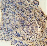 Polyclonal Rabbit anti-Human ZNF197 Antibody (aa314-343, IHC, WB)