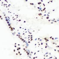 Polyclonal Rabbit anti-Human RBBP4 / RBAP48 Antibody (IHC, IF, WB)