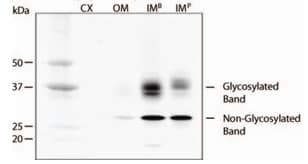 AQP2 / Aquaporin 2 Antibody (aa200-300)