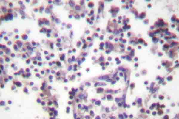 CASP3 / Caspase 3 Antibody (Asp146)