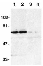 TNFRSF21 / DR6 Antibody