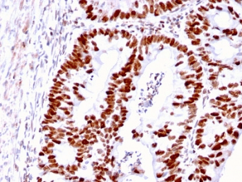MSH6 Antibody (clone MSH6/3085)