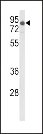 Polyclonal Rabbit anti-Human LDLR / LDL Receptor Antibody (aa391-419, WB)