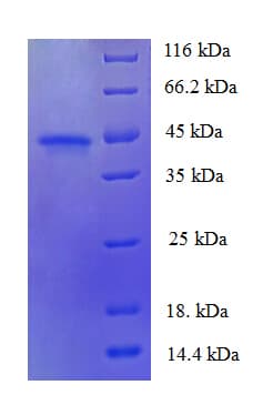 Human FAM110B / C8orf72 Protein (Recombinant His)