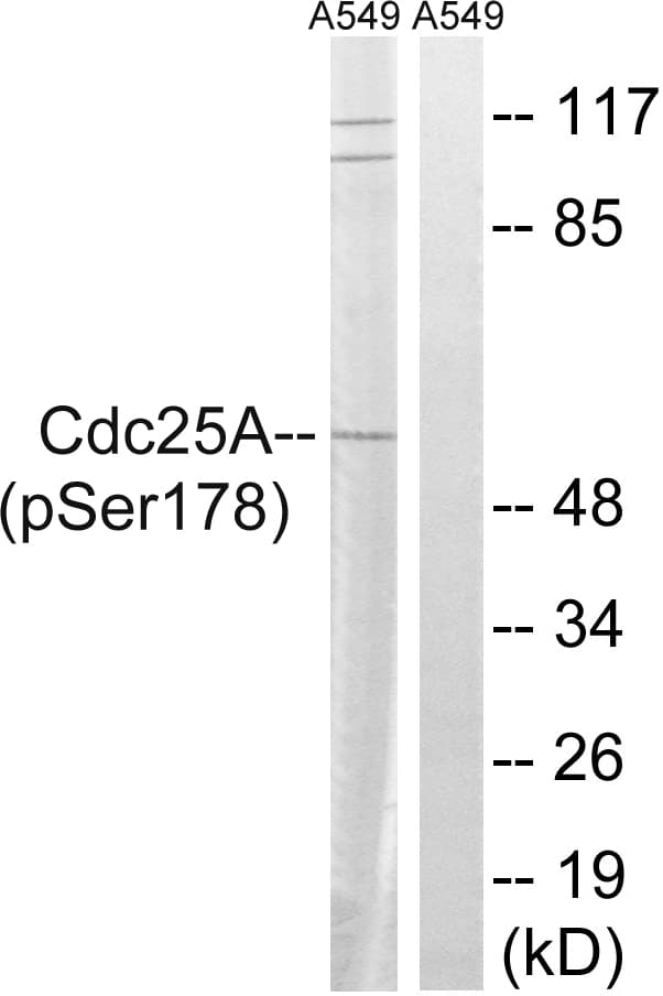 CDC25A Antibody (phospho-Ser178)