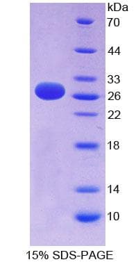 Human EFNA3 / Ephrin A3 Protein (Recombinant His-T7)