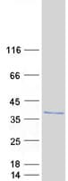 Human FAM164A / CGI-62 Protein (Recombinant Myc-DDK (Flag))