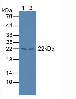 PSMB8 / LMP7 Antibody (aa80-261)
