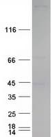 Human EIF4G1 / EIF4G Protein (Recombinant Myc-DDK (Flag))
