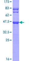 Human TTC9C Protein (Recombinant GST)