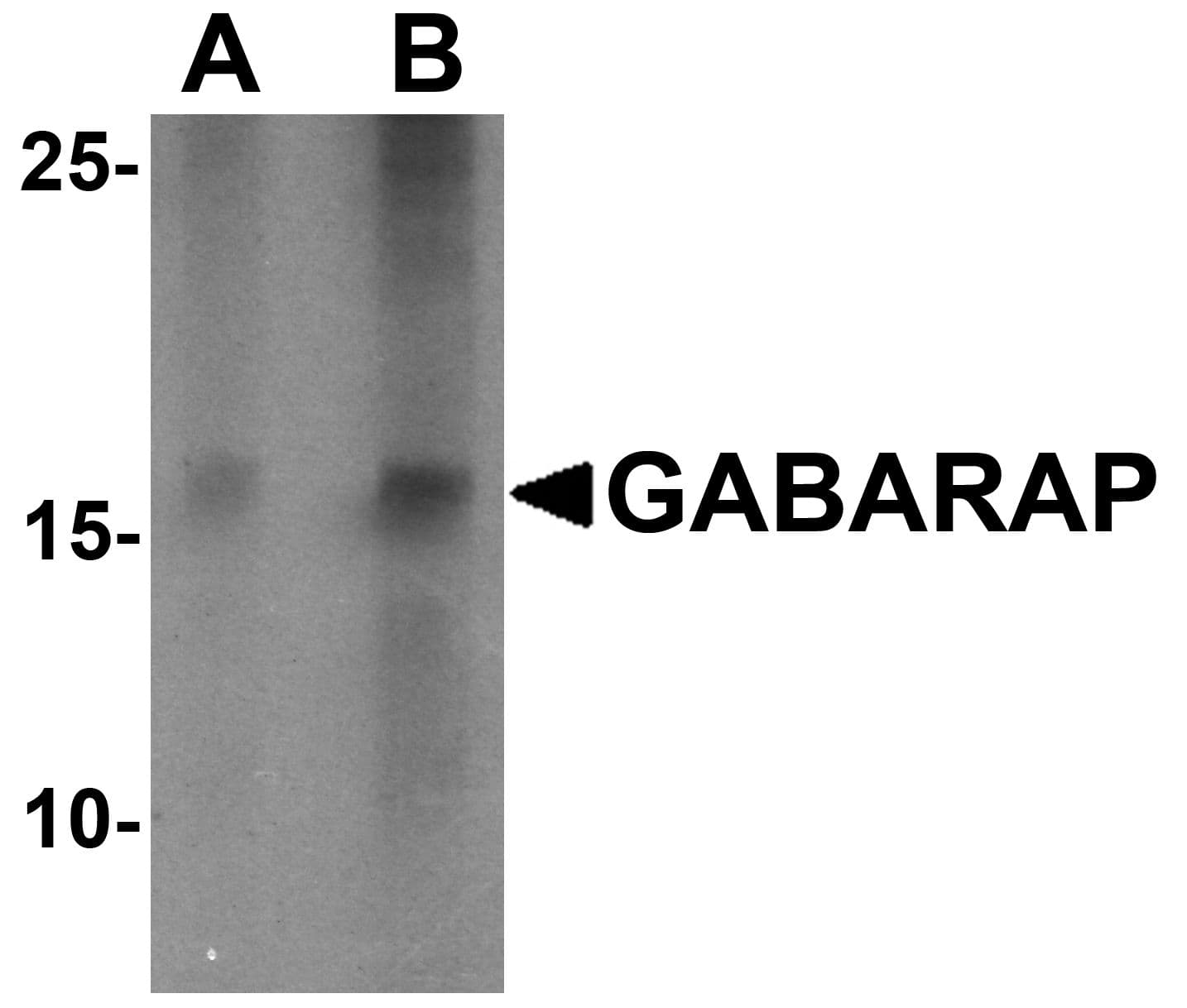 GABARAP Antibody