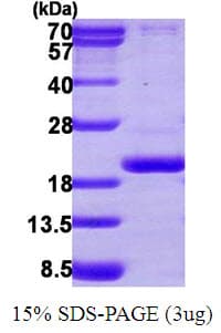 Human PPIL3 Protein (Recombinant His)
