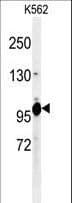 TTI1 Antibody (aa41-69)