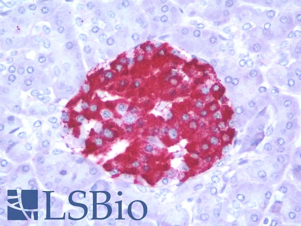 PathPlus™ Polyclonal Rabbit anti-Human MTNR1A / Melatonin Receptor 1a Antibody (Cytoplasmic Domain, IHC)