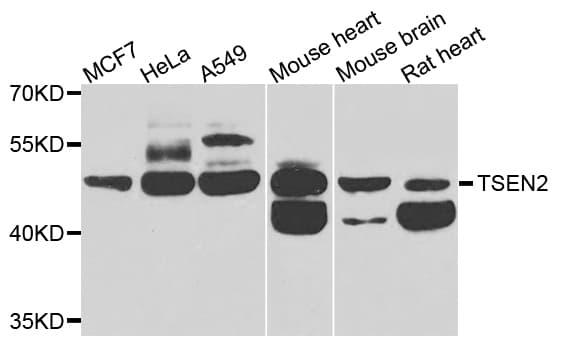 Polyclonal Rabbit anti-Human TSEN2 Antibody (IHC, IF, WB)