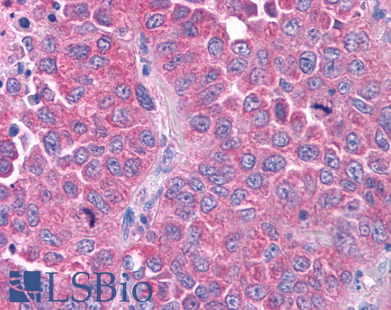 PathPlus™ GPR80 / GPR99 / OXGR1 Antibody (N-Terminus)
