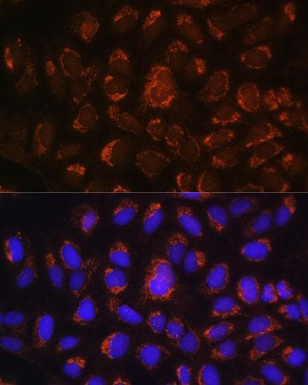ART1 /CD296 Antibody