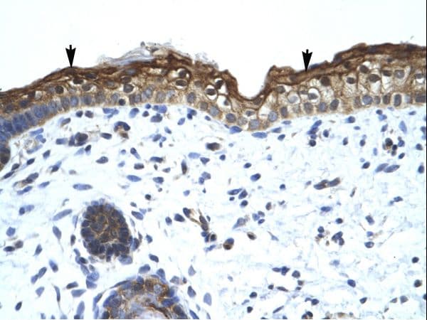SMARCA2 / BRM Antibody (aa58-107)