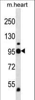 Polyclonal Rabbit anti-Human GPBB / PYGB Antibody (aa1-30, WB)