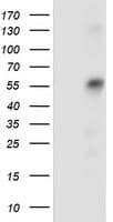 SQSTM1 Antibody (clone OTI5D5)