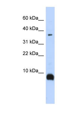 TAC3 / Tachykinin Antibody (aa36-85)