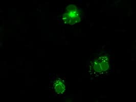 LEMD3 / MAN1 Antibody (clone OTI3H2)
