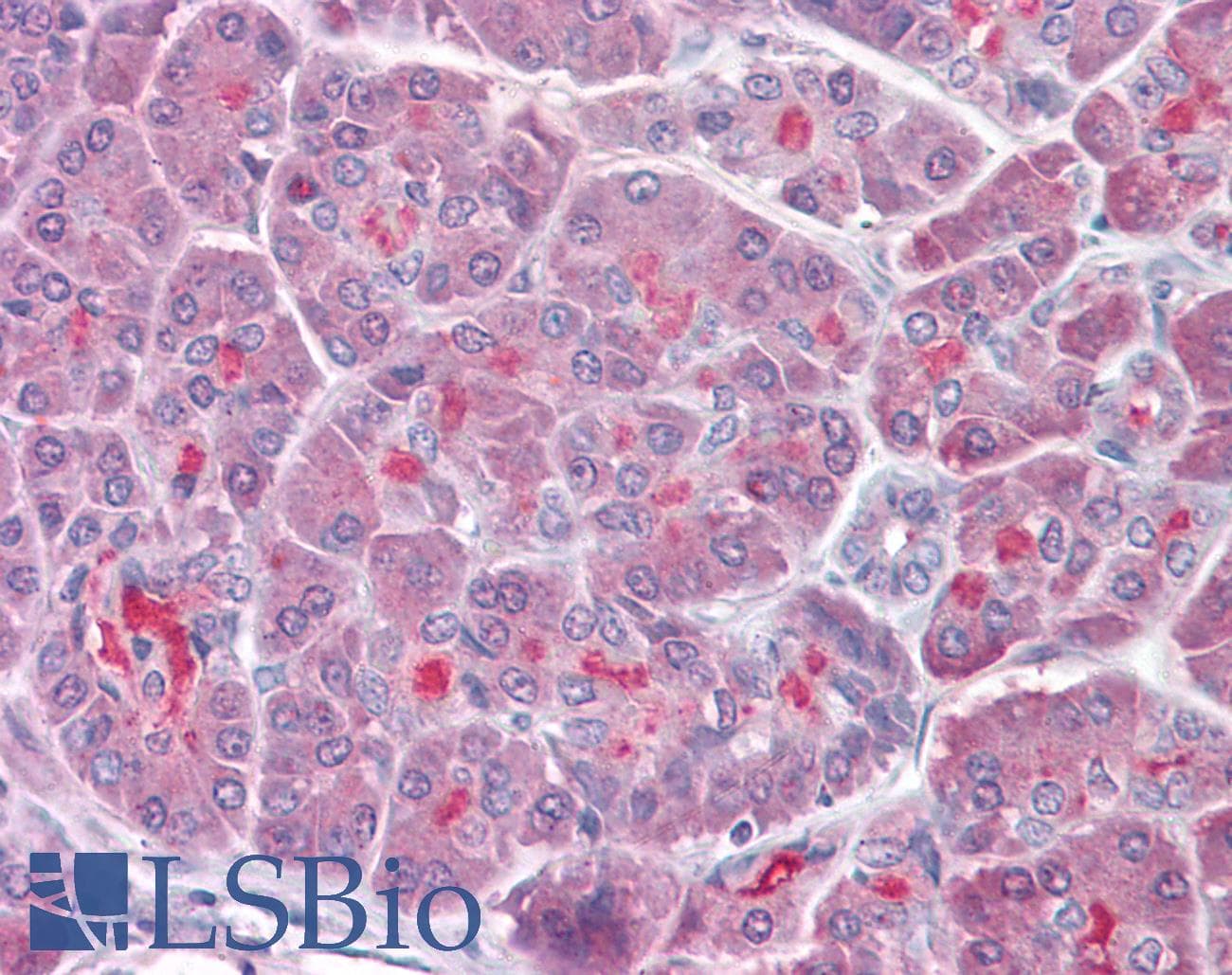 IHC-plus™ Polyclonal Rabbit anti-Human TRAF3 Antibody (aa323-340, IHC, WB)