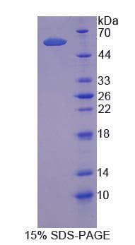 Human TRAF1 Protein (Recombinant)