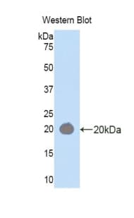 HEXB Antibody (aa315-456, Biotin)