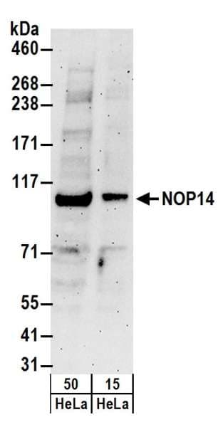 Polyclonal Rabbit anti-Human NOP14 / C4orf9 Antibody (aa750-800, WB)