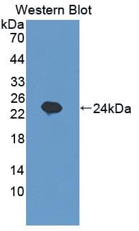 SHBG Antibody (aa44-222, Cy3)