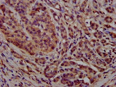 PCCB Antibody