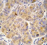 ALDH9A1 Antibody (aa445-477)