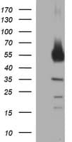 IHC-plus™ TH / Tyrosine Hydroxylase Antibody (clone 1D8)