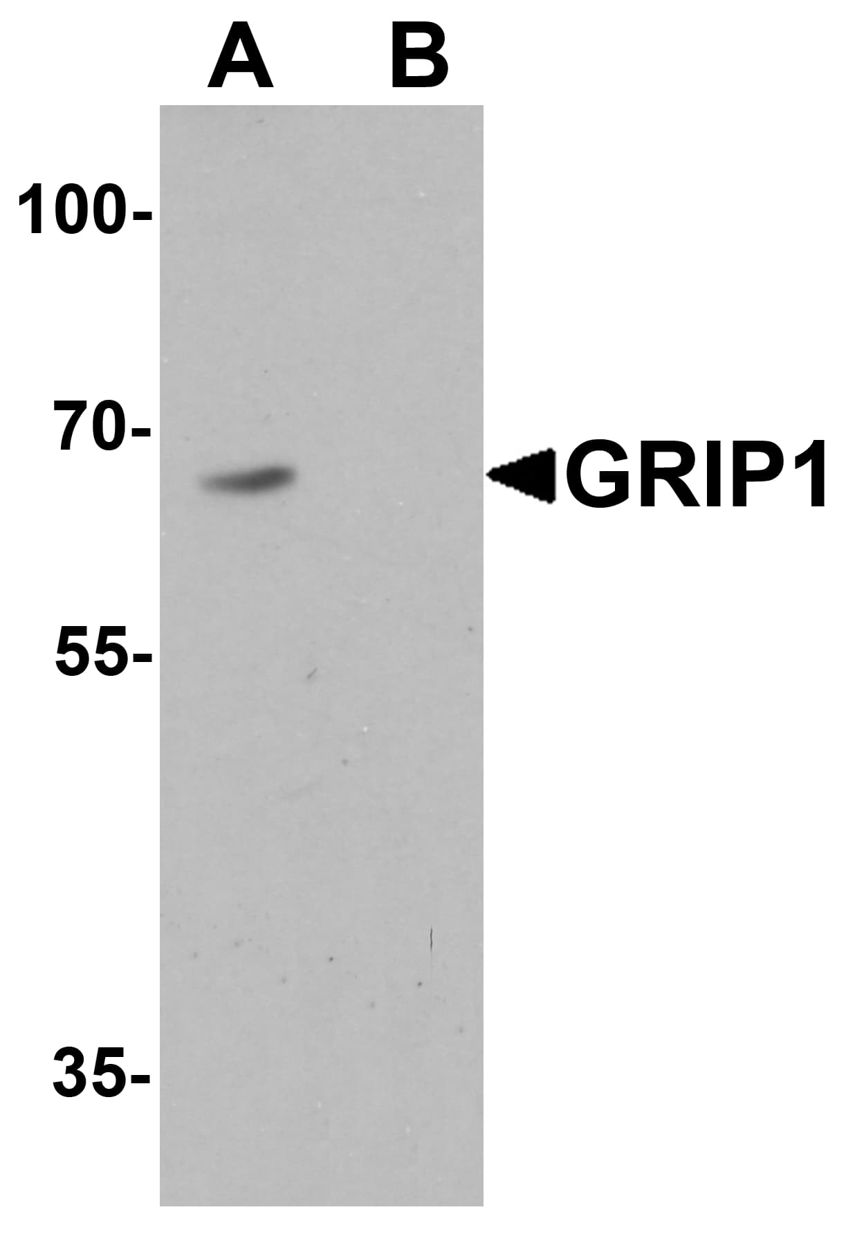 Polyclonal Rabbit anti-Human GRIP1 Antibody (IHC, IF, WB)