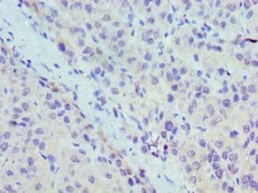 UBC6 / UBE2J2 Antibody (aa1-230)