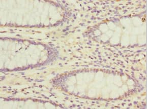 ADAD1 Antibody