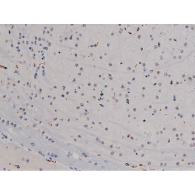 Polyclonal Rabbit anti-Human LYN Antibody (phospho-Tyr508, IHC, IF, WB)