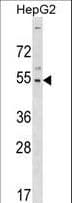 GLTSCR2 Antibody (aa430-458)